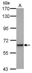 Anti-C9 antibody [N2C2-2], Internal used in Western Blot (WB). GTX110161