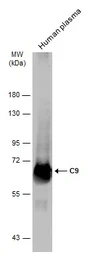Anti-C9 antibody [N2C2-2], Internal used in Western Blot (WB). GTX110161