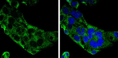 Anti-C9 antibody [N2C2-2], Internal used in Immunocytochemistry/ Immunofluorescence (ICC/IF). GTX110161