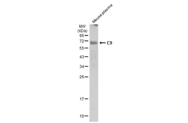 Anti-C9 antibody [N2C2-2], Internal used in Western Blot (WB). GTX110161