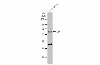 Anti-C9 antibody [N2C2-2], Internal used in Western Blot (WB). GTX110161