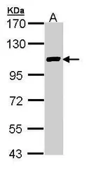Anti-FOG2 antibody used in Western Blot (WB). GTX110166