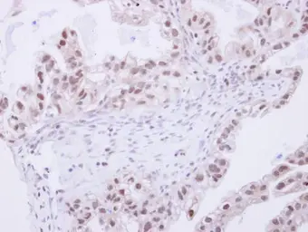 Anti-NCOA62 antibody used in IHC (Paraffin sections) (IHC-P). GTX110169