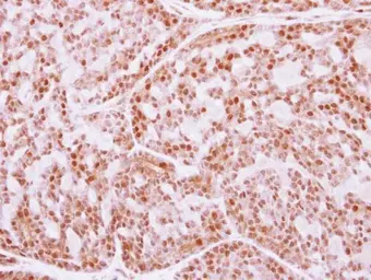 Anti-FANCE antibody [N3C3] used in IHC (Paraffin sections) (IHC-P). GTX110184