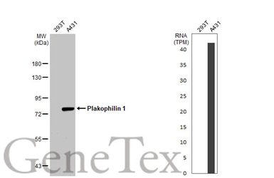 Anti-Plakophilin 1 antibody [N2C1], Internal used in Western Blot (WB). GTX110201