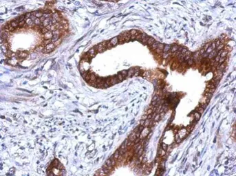 Anti-Plakophilin 1 antibody [N2C1], Internal used in IHC (Paraffin sections) (IHC-P). GTX110201