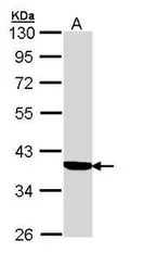 Anti-Cortisol Binding Globulin antibody [N2C3] used in Western Blot (WB). GTX110214