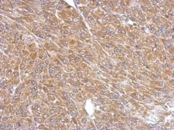 Anti-PLA2G4A antibody used in IHC (Paraffin sections) (IHC-P). GTX110218