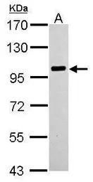 Anti-PLA2G4A antibody used in Western Blot (WB). GTX110218
