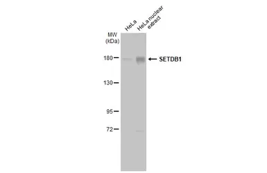 Anti-SETDB1 antibody [N2C1], Internal used in Western Blot (WB). GTX110219