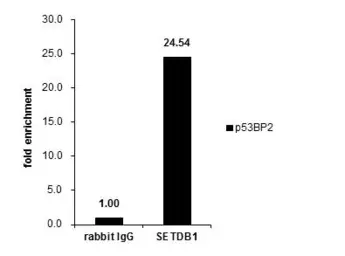Anti-SETDB1 antibody [N2C1], Internal used in ChIP assay (ChIP assay). GTX110219