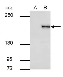 Anti-SETDB1 antibody [N2C1], Internal used in Immunoprecipitation (IP). GTX110219