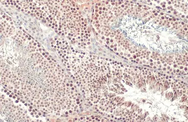 Anti-SETDB1 antibody [N2C1], Internal used in IHC (Paraffin sections) (IHC-P). GTX110219
