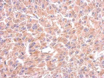 Anti-Tryptophanyl tRNA synthetase antibody used in IHC (Paraffin sections) (IHC-P). GTX110223
