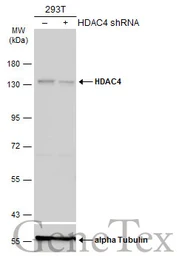 Anti-HDAC4 antibody [N3C1], Internal used in Western Blot (WB). GTX110231