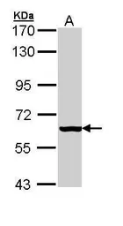 Anti-PAPSS2 antibody [C1C3] used in Western Blot (WB). GTX110232