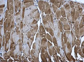 Anti-PUS1 antibody [N2C3] used in IHC (Paraffin sections) (IHC-P). GTX110249