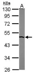 Anti-PUS1 antibody [N2C3] used in Western Blot (WB). GTX110249
