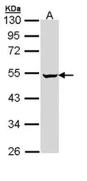 Anti-PUS1 antibody [N2C3] used in Western Blot (WB). GTX110249