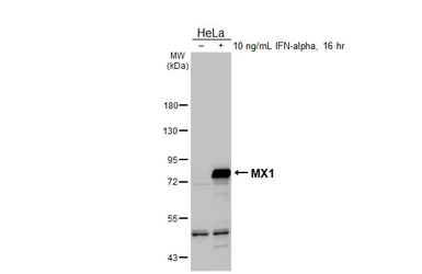 Anti-MX1 antibody [N2C2], Internal used in Western Blot (WB). GTX110256