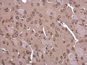 Anti-Glycine dehydrogenase antibody [N3C2-2], Internal used in IHC (Paraffin sections) (IHC-P). GTX110267