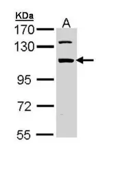 Anti-RBM28 antibody used in Western Blot (WB). GTX110268