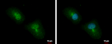 Anti-APBB2 antibody used in Immunocytochemistry/ Immunofluorescence (ICC/IF). GTX110271