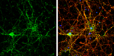 Anti-NSF antibody used in Immunocytochemistry/ Immunofluorescence (ICC/IF). GTX110275