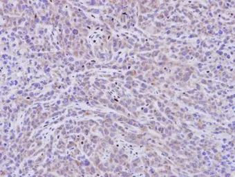 Anti-PDE11A antibody [N3C1], Internal used in IHC (Paraffin sections) (IHC-P). GTX110277