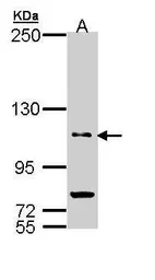 Anti-PDE11A antibody [N3C1], Internal used in Western Blot (WB). GTX110277