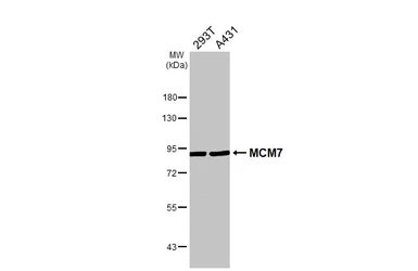 Anti-MCM7 antibody [N2C2], Internal used in Western Blot (WB). GTX110278