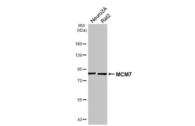 Anti-MCM7 antibody [N2C2], Internal used in Western Blot (WB). GTX110278