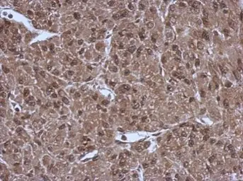 Anti-PSMC3 antibody used in IHC (Paraffin sections) (IHC-P). GTX110284