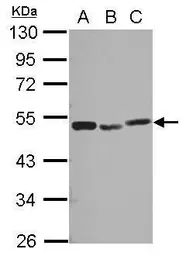 Anti-PSMC3 antibody used in Western Blot (WB). GTX110284