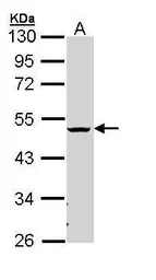 Anti-CHST5 + CHST6 antibody [N1C3] used in Western Blot (WB). GTX110290