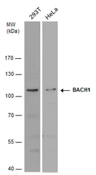 Anti-BACH1 antibody [N2C1], Internal used in Western Blot (WB). GTX110292