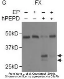 Anti-Factor X antibody used in Western Blot (WB). GTX110300
