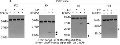 Anti-Factor X antibody used in Western Blot (WB). GTX110300