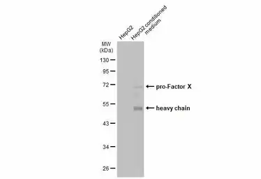 Anti-Factor X antibody used in Western Blot (WB). GTX110300