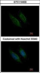 Anti-Factor X antibody used in Immunocytochemistry/ Immunofluorescence (ICC/IF). GTX110300