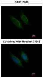 Anti-Factor X antibody used in Immunocytochemistry/ Immunofluorescence (ICC/IF). GTX110300