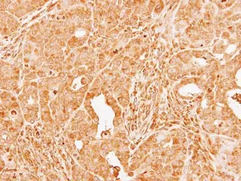 Anti-Factor X antibody used in IHC (Paraffin sections) (IHC-P). GTX110300