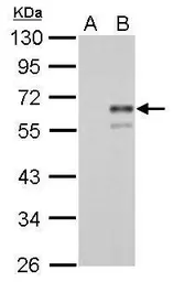 Anti-Factor X antibody used in Western Blot (WB). GTX110300