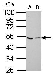 Anti-Factor X antibody used in Western Blot (WB). GTX110300