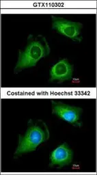 Anti-Fukutin antibody [N3C3-2] used in Immunocytochemistry/ Immunofluorescence (ICC/IF). GTX110302