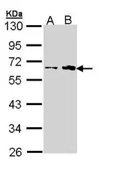 Anti-Fukutin antibody [N3C3-2] used in Western Blot (WB). GTX110302
