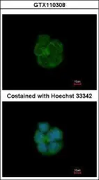 Anti-Cytokeratin 13 antibody used in Immunocytochemistry/ Immunofluorescence (ICC/IF). GTX110308