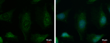 Anti-PHKA1 antibody used in Immunocytochemistry/ Immunofluorescence (ICC/IF). GTX110318