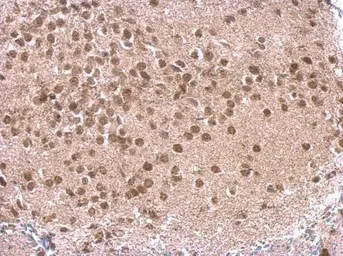 Anti-Rb2 / p130 antibody used in IHC (Paraffin sections) (IHC-P). GTX110329
