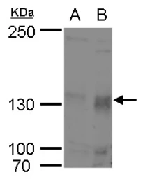 Anti-Rb2 / p130 antibody used in Western Blot (WB). GTX110329
